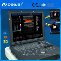 DW-C60 Grossesse 3D ordinateur portable Doppler échographie vendre